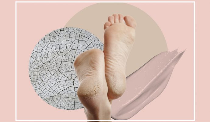 Vidhmaan Ayurvedic Anti Foot Crack Cream | Repair Creaked Heels | Moisture  Protect - Price in India, Buy Vidhmaan Ayurvedic Anti Foot Crack Cream |  Repair Creaked Heels | Moisture Protect Online