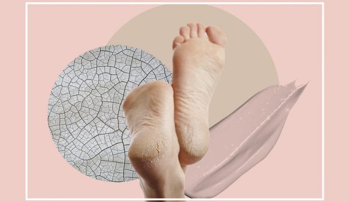 Heal Cracked Heels Using Ayurvedic Treatments – MyCocoSoul